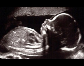 /Content/ServiceImages/2-try (1).jpg